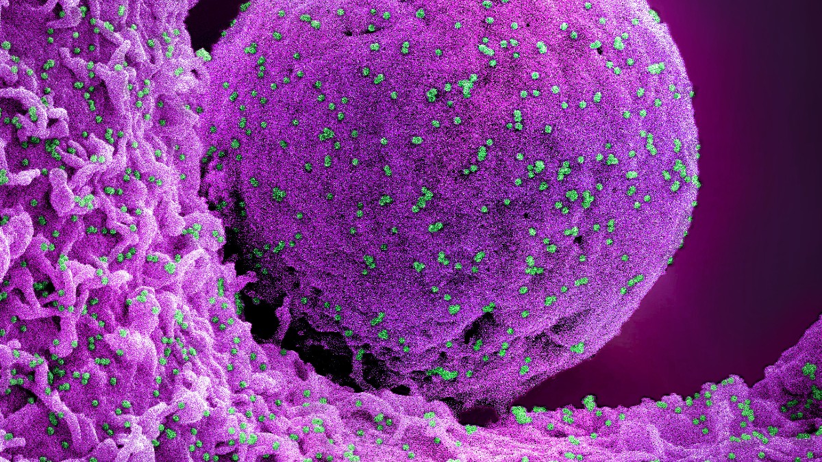 Colorized electron micrograph of a cell infected with teal-colored SARS-CoV-2 particles.