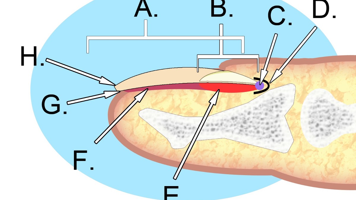 Labeled anatomical diagram showing the structures of a human fingernail, including the nail plate, matrix, bed, and surrounding skin.