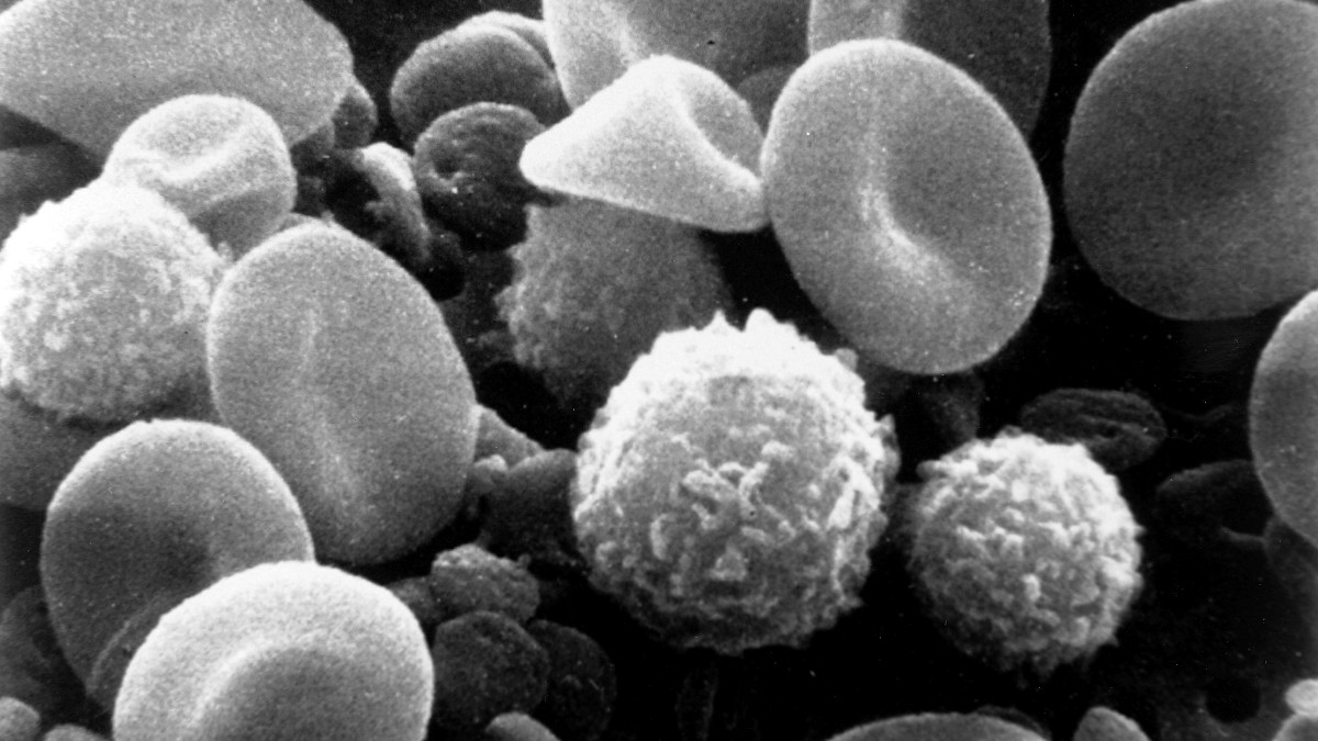 Colorized scanning electron micrograph showing many red blood cells and a white blood cell.