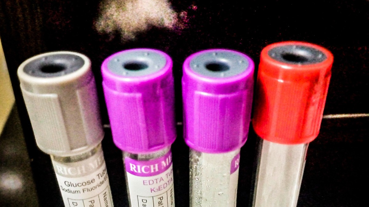 Four blood collection tubes with gray, purple and red caps standing in a rack.