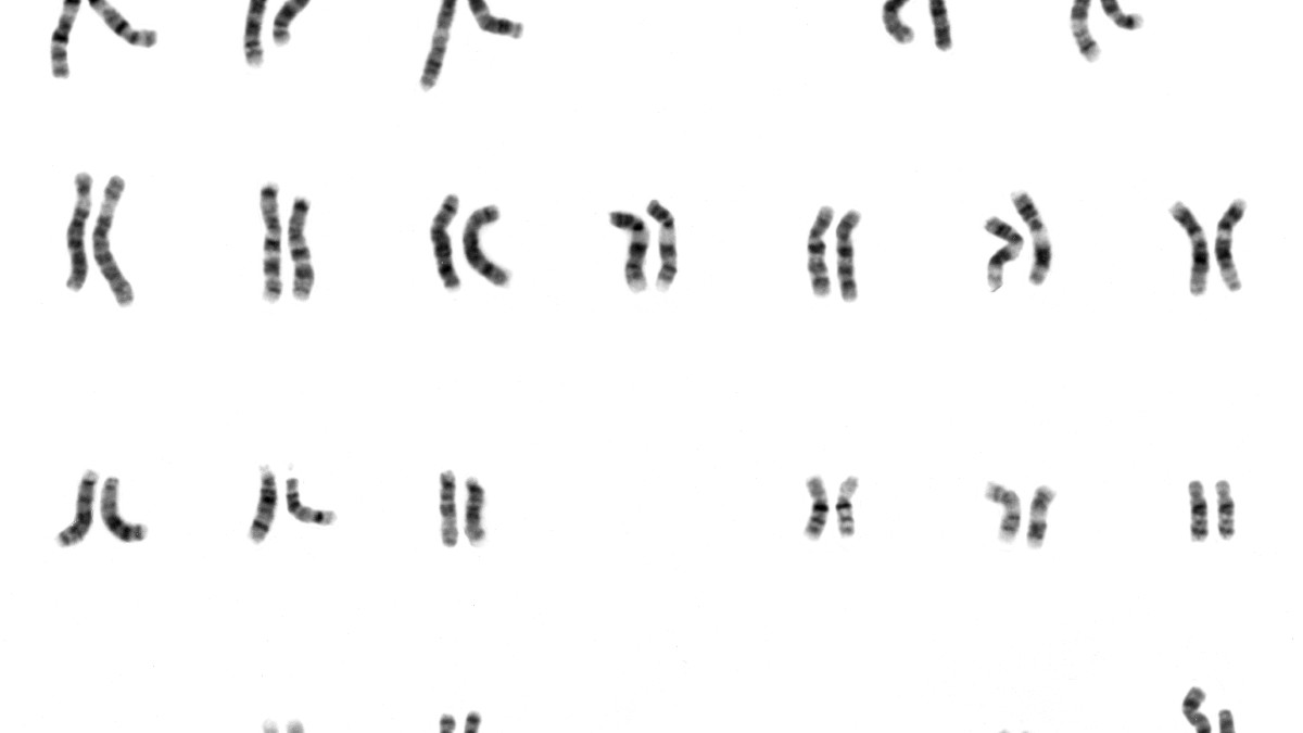 A human karyotype: the 23 pairs of chromosomes from one cell, stained and arranged by size, including an X and a Y chromosome.